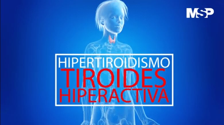 #ExclusivoMSP I Hipertiroidismo: Tiroides Hiperactiva