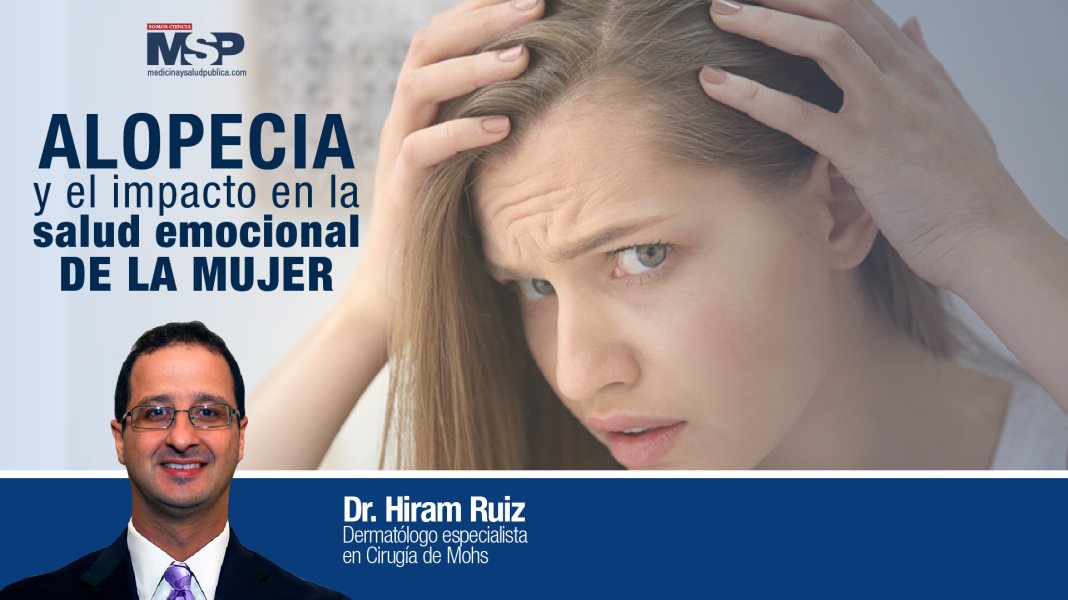 #ExclusivoMSP I Alopecia y el impacto en la salud emocional de la mujer