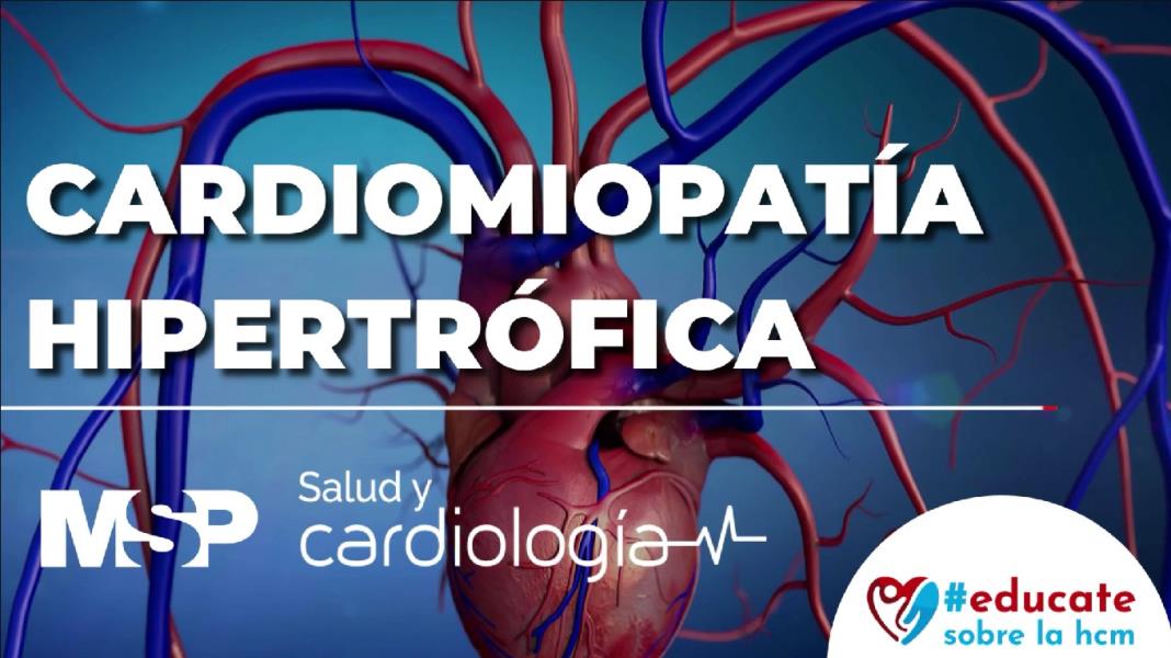 Entendiendo la Cardiomiopatía Hipertrófica: Dr. Luis Molinary, Cardiólogo
