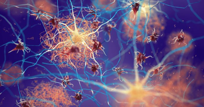 Los metabolitos circulantes podrían predecir la patogénesis del Alzheimer, según estudio