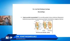 Artritis reumatoide: una descripción general