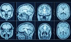 Cómo se desarrolla y madura el cerebro humano desde la concepción hasta la muerte