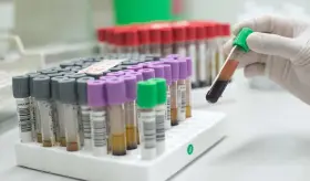 Estudio: Análisis de sangre ayudaría a pacientes sin signos de cáncer a detectar tumores