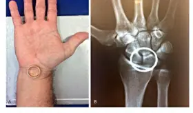 Las lesiones traumato-ortopédicas de Jesucristo