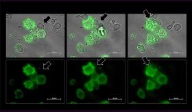 Mediante un “beso” células cancerígenas se abren camino frente a las defensas del cuerpo