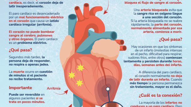 Paro cardíaco vs Infarto - Infografía