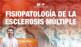 #ExclusivoMSP Fisiopatología de la Esclerosis Múltiple con el Dr. Ángel Chinea