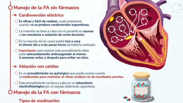 Fibrilación Auricular - Infografía Fibrilación Auricular - Infografía