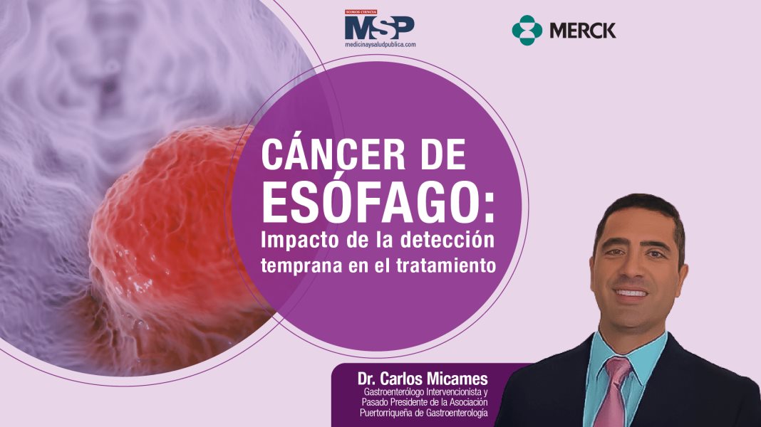 #ExclusivoMSP I Cáncer de Esófago: Impacto de la detección temprana en el tratamiento