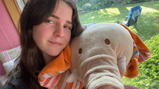 La mutación genética de una niña ilumina las causas del enigmático lupus La mutación genética de una niña ilumina las causas del enigmático lupus