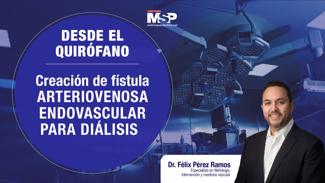 #DesdeElQuirofano I Creación de fístula arteriovenosa endovascular para diálisis