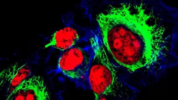 Henrietta Lacks: la madre de la medicina moderna