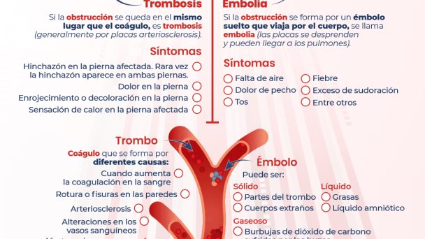 Trombosis vs Embolia - Infografía Trombosis vs Embolia - Infografía