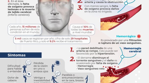 Accidentes Cerebrovasculares - Infografías