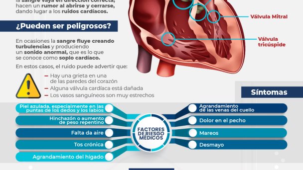 Soplos Cardíacos - Infografía