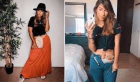 #EspecialIBD I @Ostomychick: Un ejemplo de superación