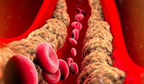 ¿Es el colesterol bueno o malo, cómo entenderlo?