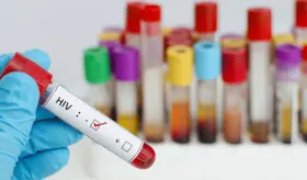 Medicamento clínicamente seguro para el VIH, con un 99 % de los virus inhibidos en el cuerpo