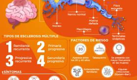 Esclerosis Múltiple - Infografía