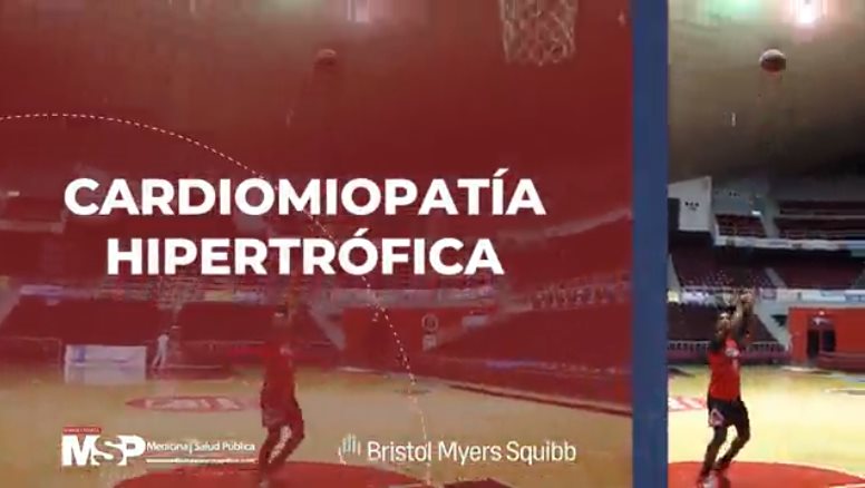 Cuida tu corazón de la #MiocardiopatíaHipertrófica