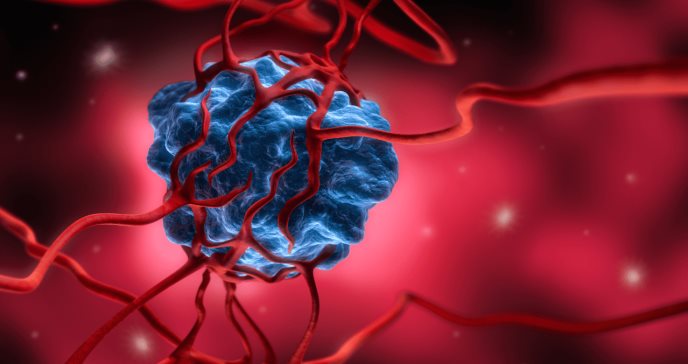 Estudio indica que terapia dirigida para el cáncer de riñón está asociada a mayor riesgo cardíaco