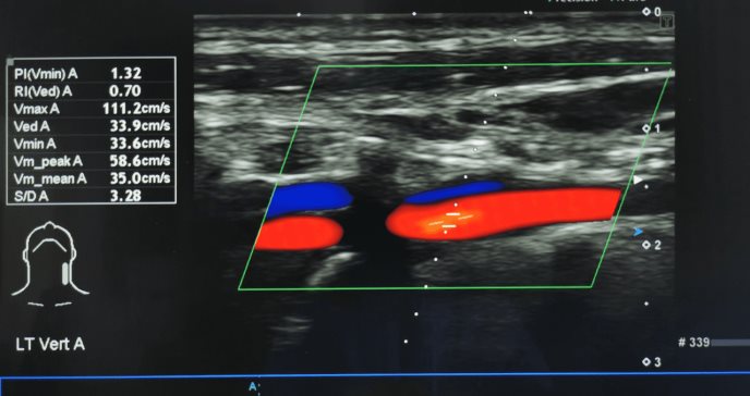 Enfatizan en el beneficio de la ecografía intravascular durante las intervenciones arteriales y venosas