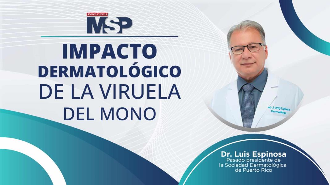 #ProgramaEspecial I Impacto dermatológico de la Viruela del Mono