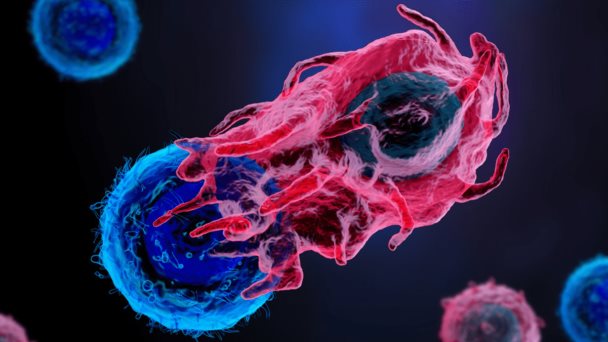La quimio-inmunoterapia eleva la supervivencia en el agresivo cáncer de pulmón
