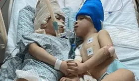 El revolucionario método con el que separaron a unos siameses unidos por el cerebro