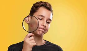 La pubertad de los niños: cambios físicos y hormonales