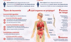 Leucemia - Infografías