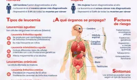 Leucemia - Infografías