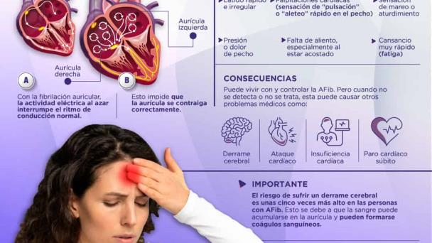 Fibrilación auricular - Infografía