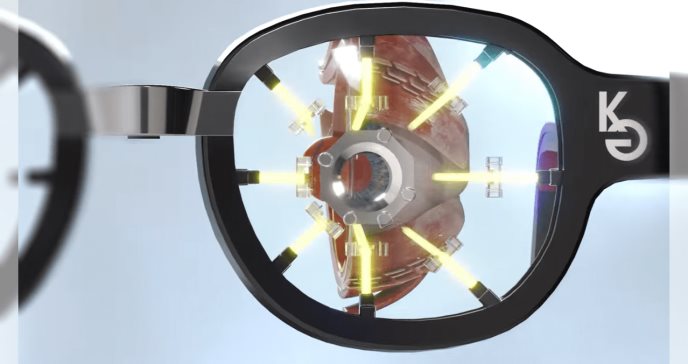 Nuevas gafas con nanoproyectores prometen curar la miopía a través del entrenamiento visual