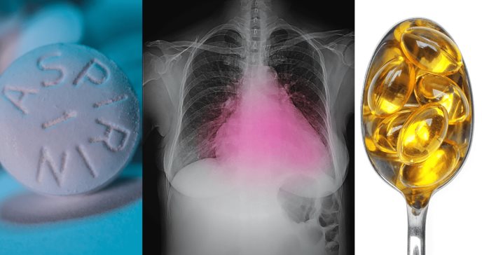 Ácido acetilsalicílico y omega-3 no reducen el riesgo insuficiencia cardiaca en pacientes diabéticos