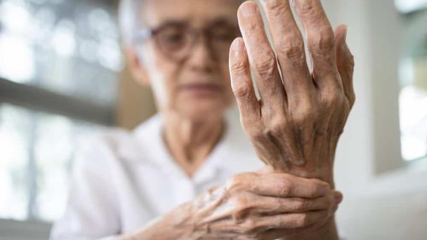 Estos son los efectos de la artritis reumatoide en el sistema cardiovascular