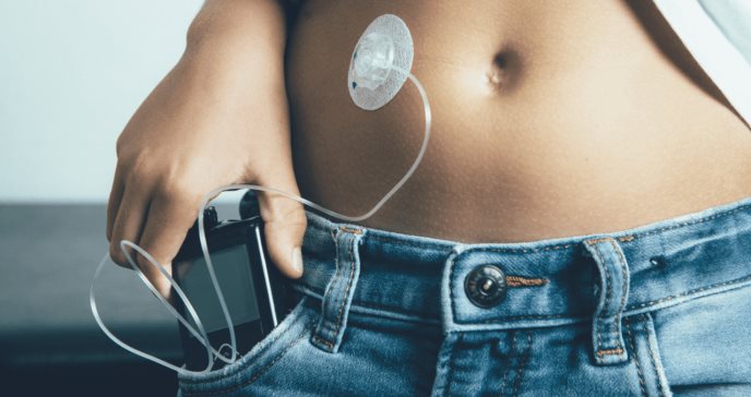 Desarrollan ‘páncreas artificial’ que mejora el control glucémico en niños con diabetes