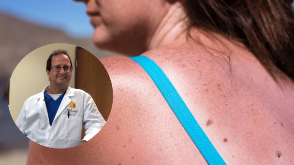 ¿“Baños de sol” para obtener vitamina D? No hay ninguna evidencia, advierte dermatólogo ¿“Baños de sol” para obtener vitamina D? No hay ninguna evidencia, advierte dermatólogo