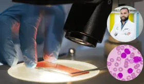 Leucemia linfocítica crónica: principales diferencias con linfomas y opciones de tratamiento