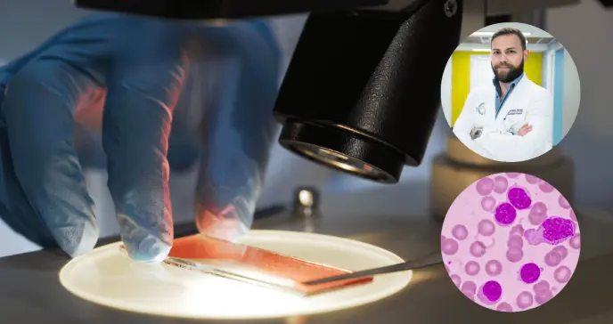 Leucemia linfocítica crónica: principales diferencias con linfomas y opciones de tratamiento