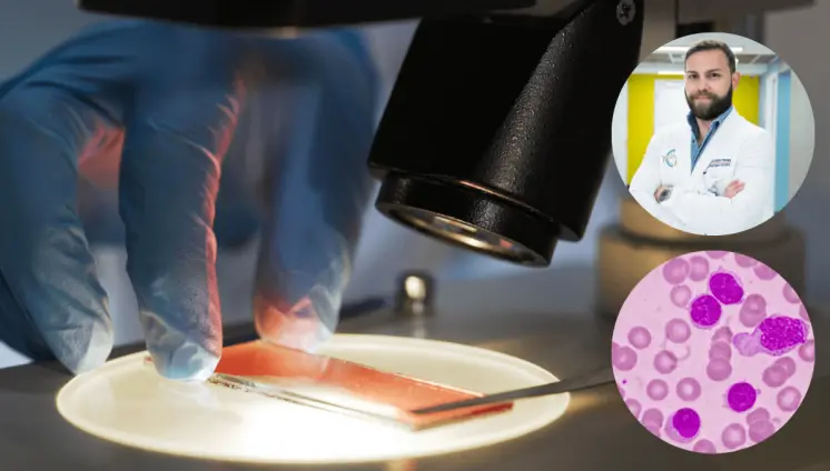 Leucemia linfocítica crónica: principales diferencias con linfomas y opciones de tratamiento