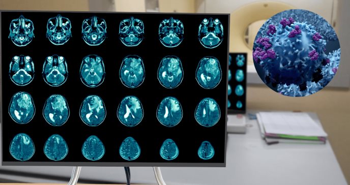 Fármaco podría eficacia contra el tumor cerebral más común y agresivo, según investigación