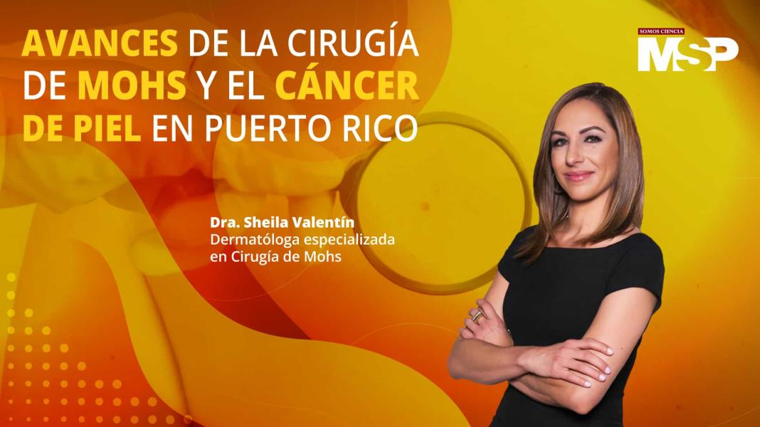 #ProgramaEspecial | Avances de la cirugía de Mohs y el cáncer de piel en Puerto Rico