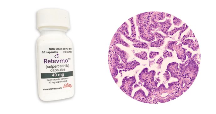 FDA aprueba Selpercatinib, el primer inhibidor para tumores metastásicos del gen RET