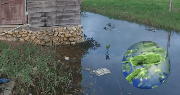 Aumentan infecciones por bacteria “come carne”, vibrio vulnificus, en Florida tras paso de Ian
