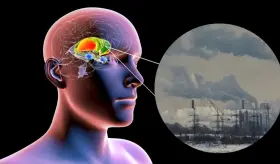 Registran cambios cerebrales en niños expuestos a ciertos grados de contaminación atmosférica