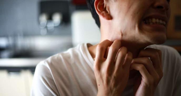 Acompañantes de pacientes con psoriasis están predispuestos a sufrir de ansiedad