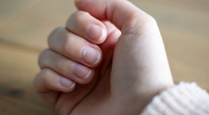 Cambios en algunos tejidos externos en pacientes que padecen de cáncer