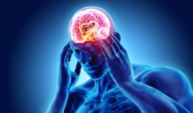 Migraña: claves en fisiopatología y terapéutica