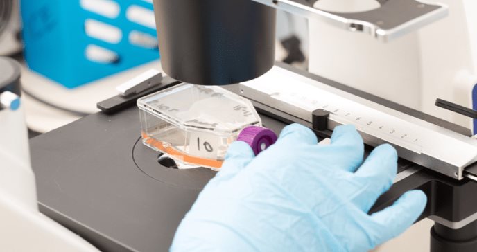 Nuevos avances médicos mejorarían el pronóstico del cáncer renal